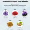 Acne Scar Removal Cream Pimples Surgical Scar Stretch Marks Face Gel Remove Smoothening Whitening Body Skin Care Creme - Image 4