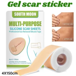2pcs 150cm Silicone Gel Scar Sheet Patch Treatment Removal Tape Acne Trauma Burn Scar Cover Skin Repair Section Ear Beauty