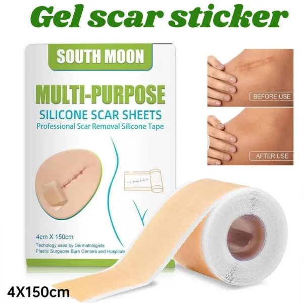 2pcs 150cm Silicone Gel Scar Sheet Patch Treatment Removal Tape Acne Trauma Burn Scar Cover Skin Repair Section Ear Beauty