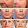 Collagen Wrinkle Remover Face Serum Anti Aging Whitening Moisturizing Fade Fine Lines Dark Spots Beauty Brighten Care Cosmetics - Image 2