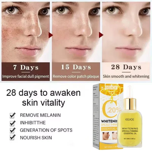 Vitamin C Whitening Freckles Serum Remove Dark Spots Freckles Fade Melanin Nicotinamide Essence Brighten Moisturizing Skin Care - Image 3