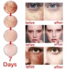 Whitening Freckles Face Cream Removal Melasma Dark Spots Corrector Lighten Melanin Pigmentation Brighten Anti-Aging Beauty Care - Image 3