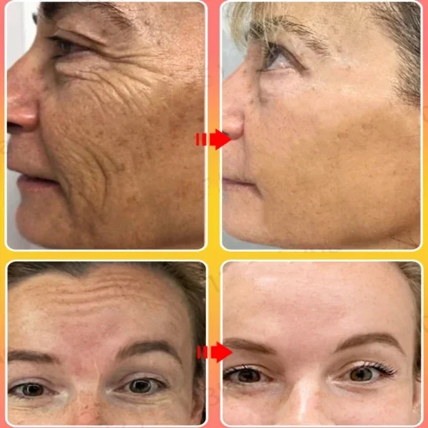 Sakura Whitening Face Cream Wrinkle Remover Fade Fine Lines Serum Firm Lift Shrink Pores Moisturizing Brighten Smooth Skin Care - Image 2