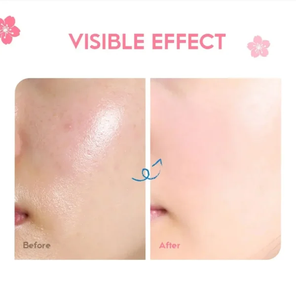 Sakura Whitening Face Cream Wrinkle Remover Fade Fine Lines Serum Firm Lift Shrink Pores Moisturizing Brighten Smooth Skin Care - Image 4