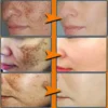 Effective Whitening Freckles Face Cream Remove Melasma Dark Spots Fade Melanin Acne Scars Anti-aging Brighten Repair Skin Care - Image 2