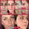 Whitening Freckles Face Cream Removal Melasma Dark Spots Corrector Lighten Melanin Pigmentation Brighten Anti-Aging Beauty Care - Image 2