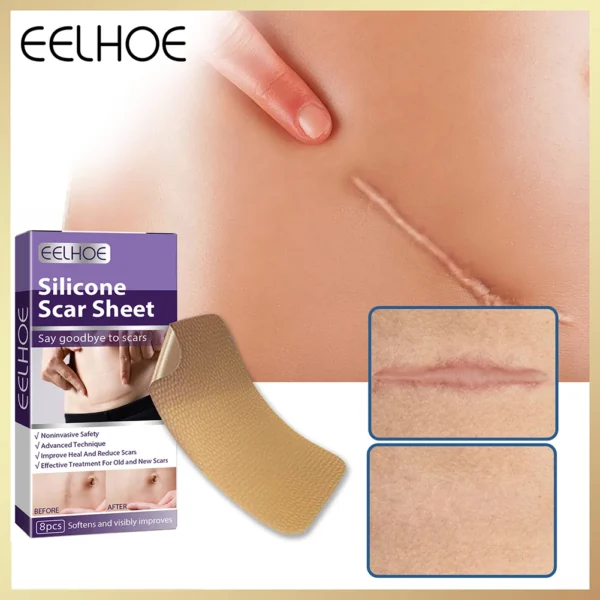 16pcs=2boxes Silicone Scar Invisible Sticker Skin Color Surgery Burn Skin Tape Acne Cover Sticker Silicone Gel Scar Cover