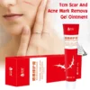 Acne Scar Removal Cream Pimples Surgical Scar Stretch Marks Face Gel Remove Smoothening Whitening Body Skin Care Creme - Image 3