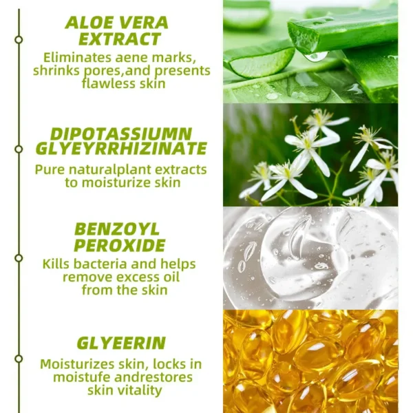 30g Acne Cream soothes, hydrates, helps regulate oil, reduces redness, and enhances skin texture with a moisturizing feel - Image 3